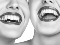 Отбеливание зубов: что нужно знать о популярной процедуре