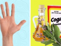 Что делать, если потеют руки