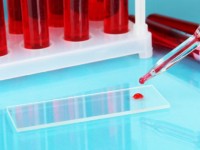 Почему у людей разные группы крови и на что это влияет