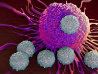 5 способов проверить себя на рак