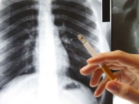 Как защитить лёгкие от городского смога и пыли