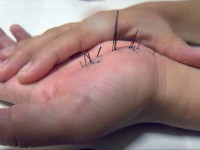 Что будет, если наступить на иголку