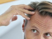 Как предотвратить выпадение волос: 4 способа, проверенных медициной