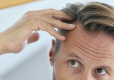 Как предотвратить выпадение волос: 4 способа, проверенных медициной
