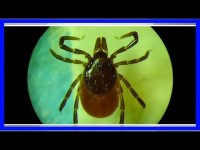 Нужна ли прививка от клещевого энцефалита вам и вашим близким