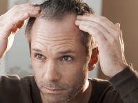 5 причин выпадения волос, о которых вы могли не задумываться