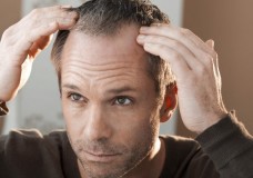 5 причин выпадения волос, о которых вы могли не задумываться