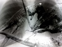 Как защитить себя от рака. Самые популярные советы базы знаний Quora