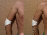 Как принять душ не снимая повязки?