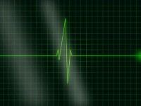 Ученые рассказали о том, как часто можно делать рентген, ЭКГ, маммографию и УЗИ